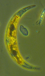 Foto af Closterium incurvum (Closterium incurvum) | Standardfoto
