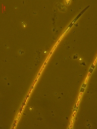 Foto af Closterium gracile var. elongatum (Closterium gracile var. elongatum) | Standardfoto