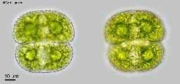 Foto af Cosmarium stratioticola (Cosmarium stratioticola) | Standardfoto