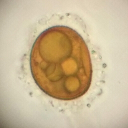 Foto af Glat døgnmos (Ephemerum serratum var. serratum) | Præparat