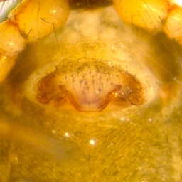 Foto af Agyneta conigera (Agyneta conigera) | Hunnens epigyn