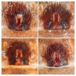 Foto af Alopecosa taeniata (Alopecosa taeniata) | Variation i epigyner (Leck Fischers dyr)