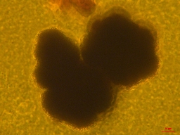 Foto af Botryococcus neglectus (Botryococcus neglectus) | Standardfoto