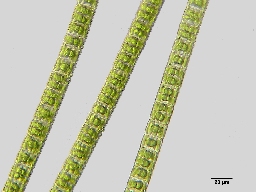 Foto af Hyalotheca mucosa (Hyalotheca mucosa) | Standardfoto