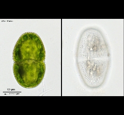 Foto af Actinotaenium turgidum (Actinotaenium turgidum) | Standardfoto