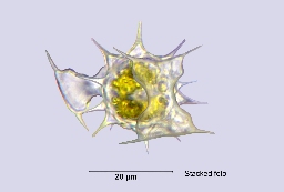 Foto af Staurodesmus extensus (Staurodesmus extensus) | Danner zygospore