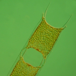 Foto af Odontella chinensis (Odontella chinensis) | Standardfoto