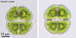 Foto af Cosmarium formosulum (Cosmarium formosulum) | Standardfoto
