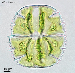 Foto af Micrasterias truncata (Micrasterias truncata) | Standardfoto