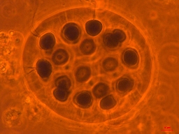 Foto af Pandorina morum (Pandorina morum) | Standardfoto