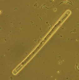 Foto af Gonatozygon kinahanii (Gonatozygon kinahanii) | Standardfoto
