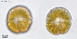 Foto af Gymnodinium mirabile (Gymnodinium mirabile) | Standardfoto